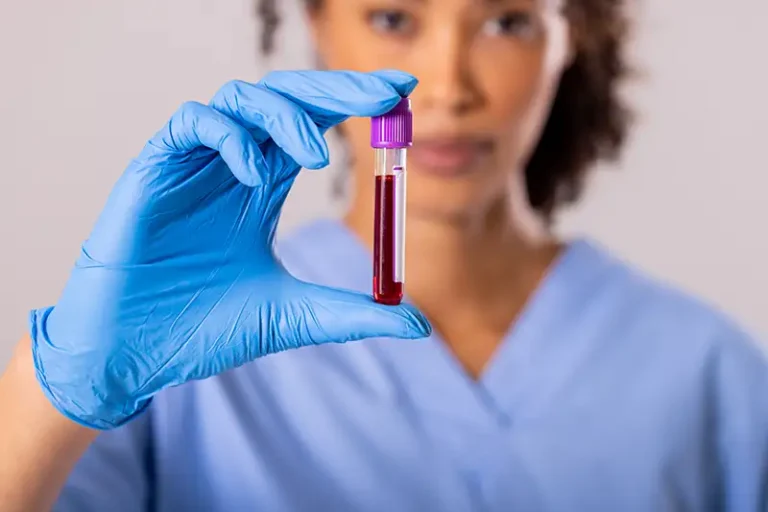 Why Comprehensive Blood Work Is Essential Before Starting Hormone Therapy 7 Comprehensive Blood Work